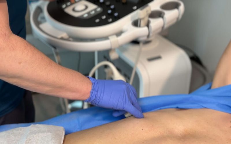 Elastografía Hepática Antofagasta 