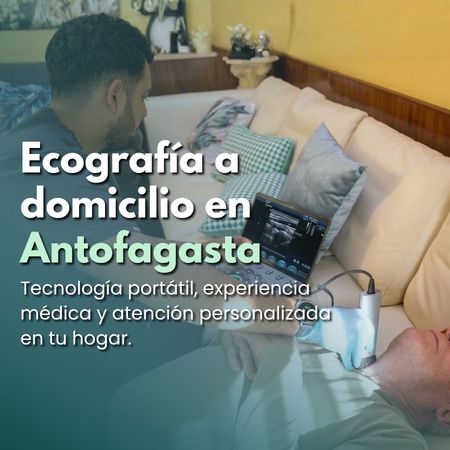 Ecografía a domicilio Ecografía a domicilio